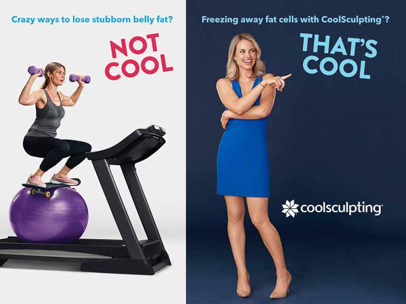 Freezing away fat cells with Coolsculpting