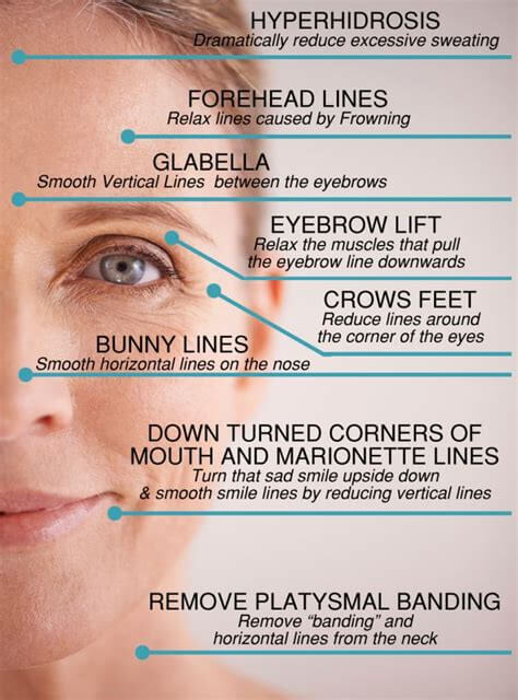 Botox Guide