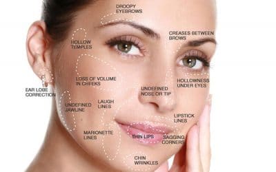 Let’s talk about dermal fillers