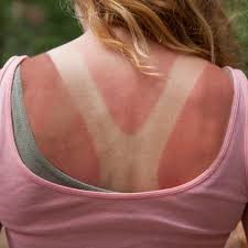 woman putting sunscreen on her back